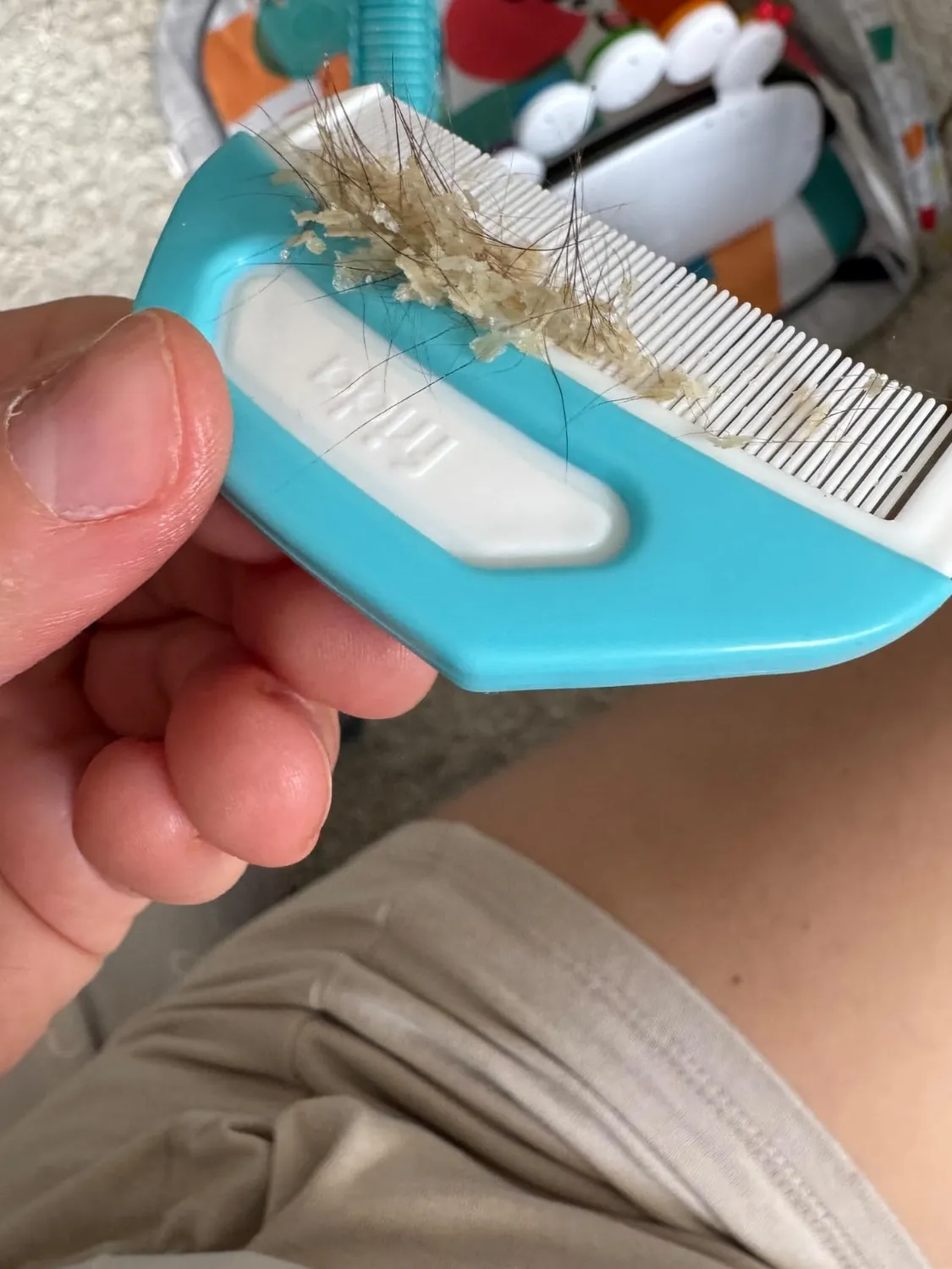 Frida Baby DermaFrida FlakeFixer Milchschorf 3-teilig