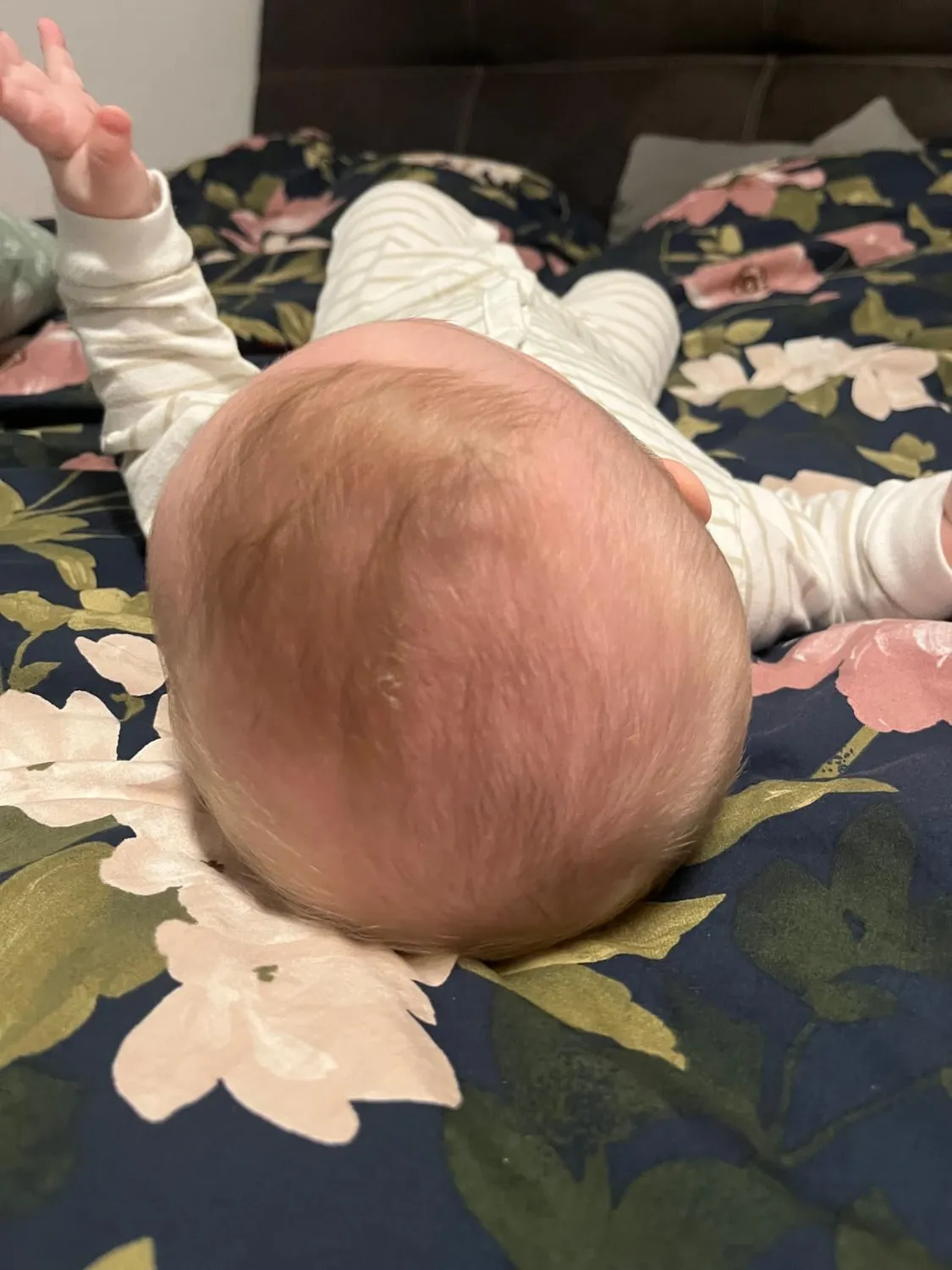 Frida Baby DermaFrida FlakeFixer Milchschorf 3-teilig
